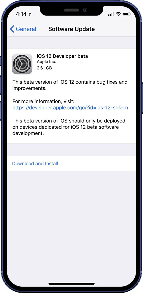 How To Fix iOS 15 Update Not Showing Up in Settings Step 1